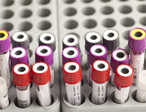 Why Annual Blood Work Is Critical for Detecting Early Health Issues